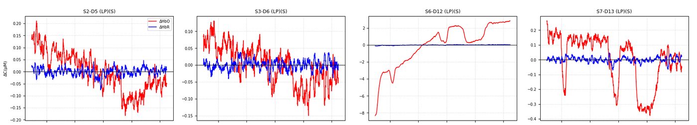 Four panels of fNIRS haemodynamic time series: red HbO and blue HbR over ten minutes for several channels